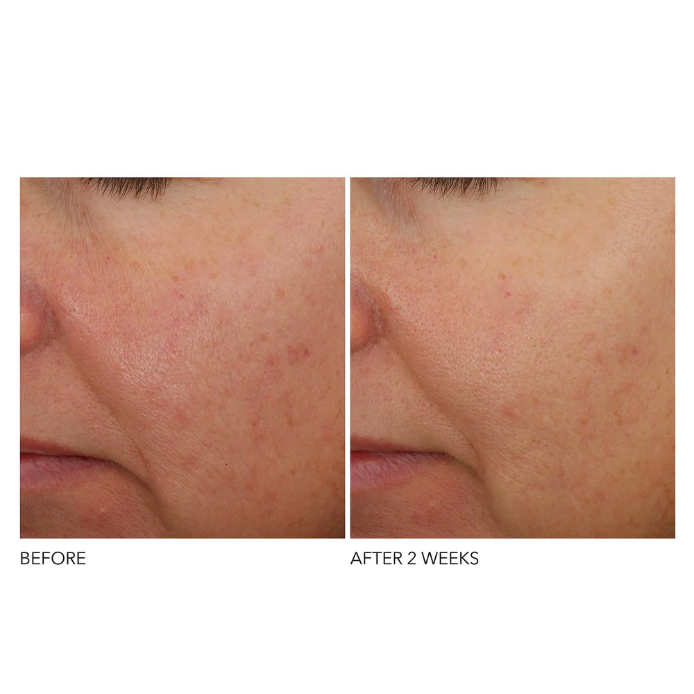 Dr Dennis Gross Overnight application shot illustrating calm, consistent nightly routine.
