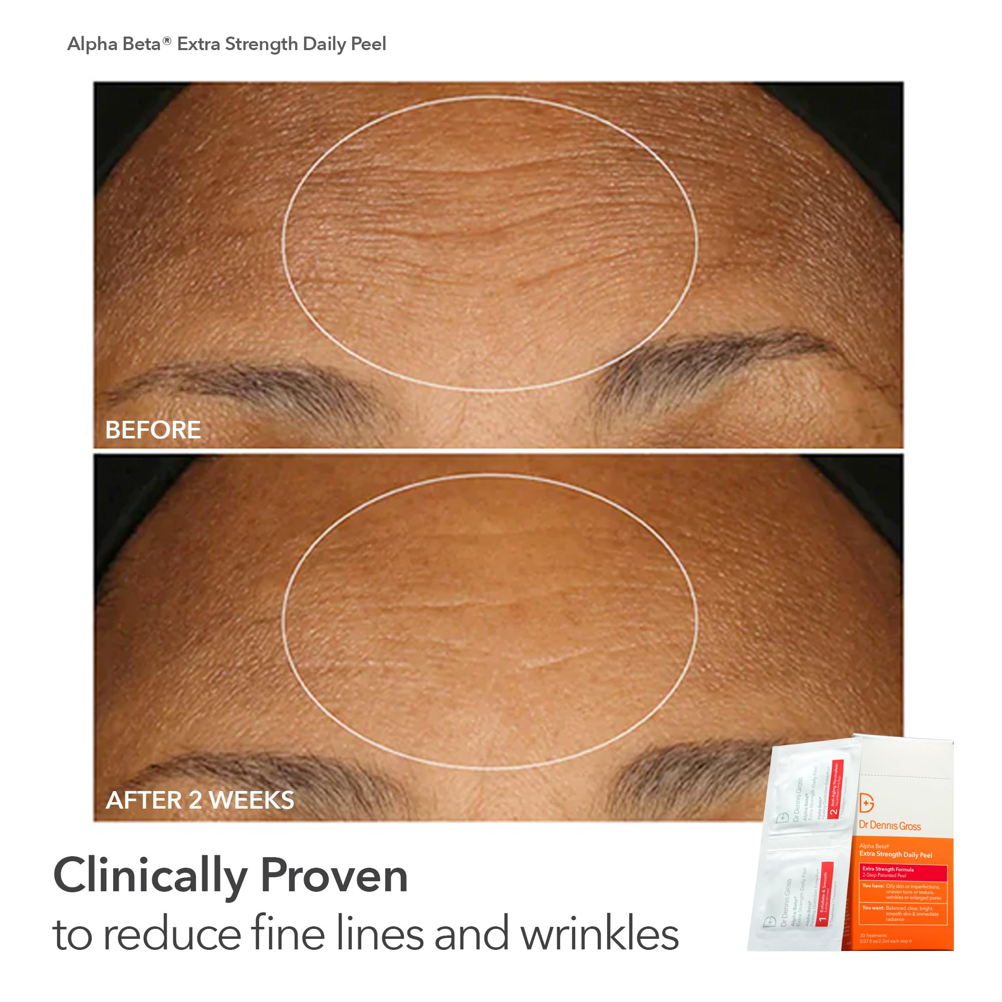 Dr Dennis Gross Peel Vault Kit gift-ready packaging for gifting skincare lovers.