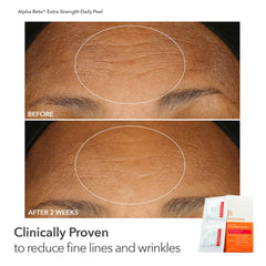 Dr Dennis Gross Peel Vault Kit gift-ready packaging for gifting skincare lovers.