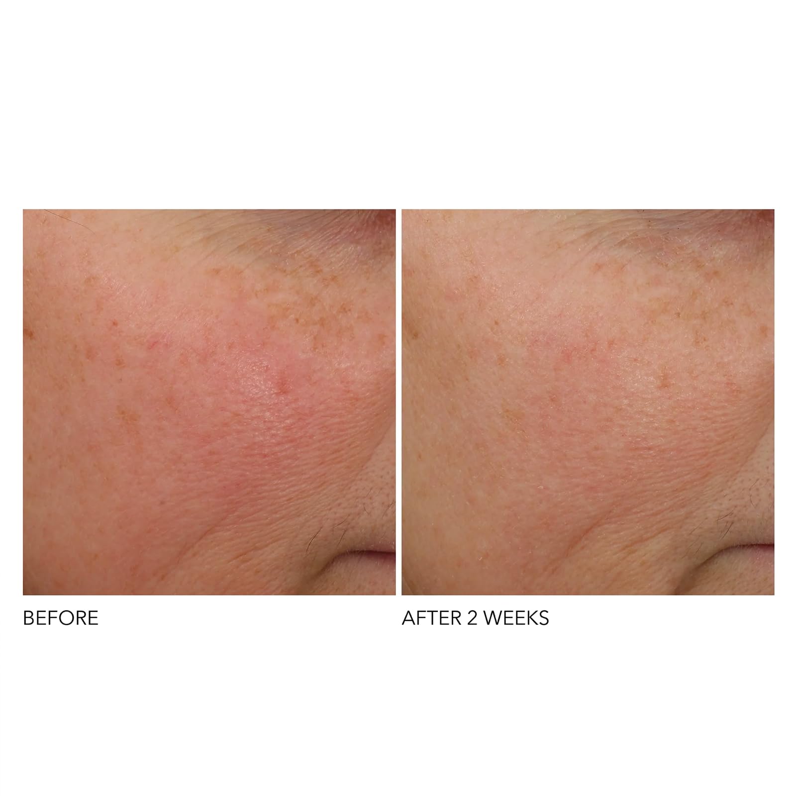 Dr Dennis Gross Phyto-Retinol Blend ingredients image with botanical actives.