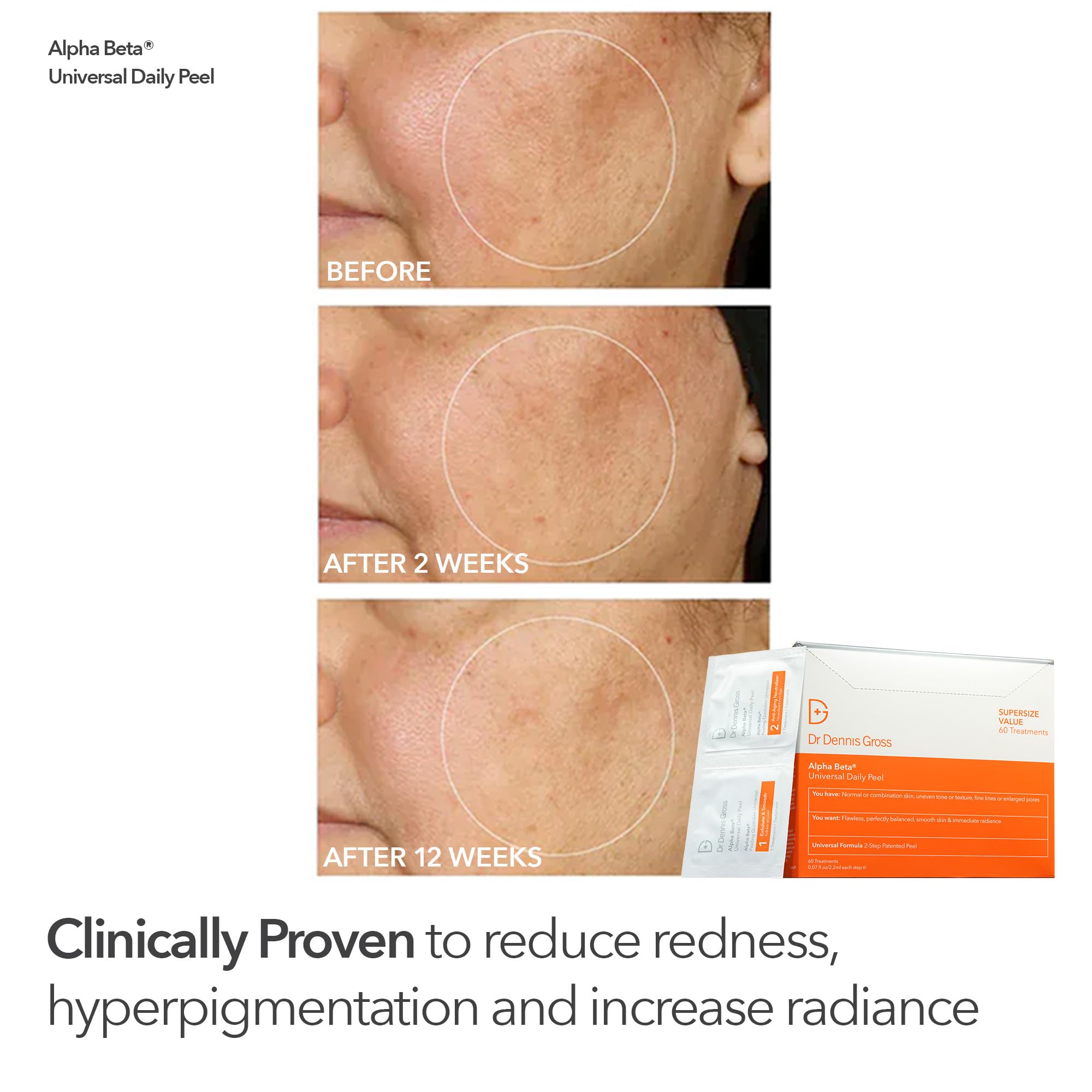Dr Dennis Gross Universal Daily Peels for everyday radiance and smooth texture.