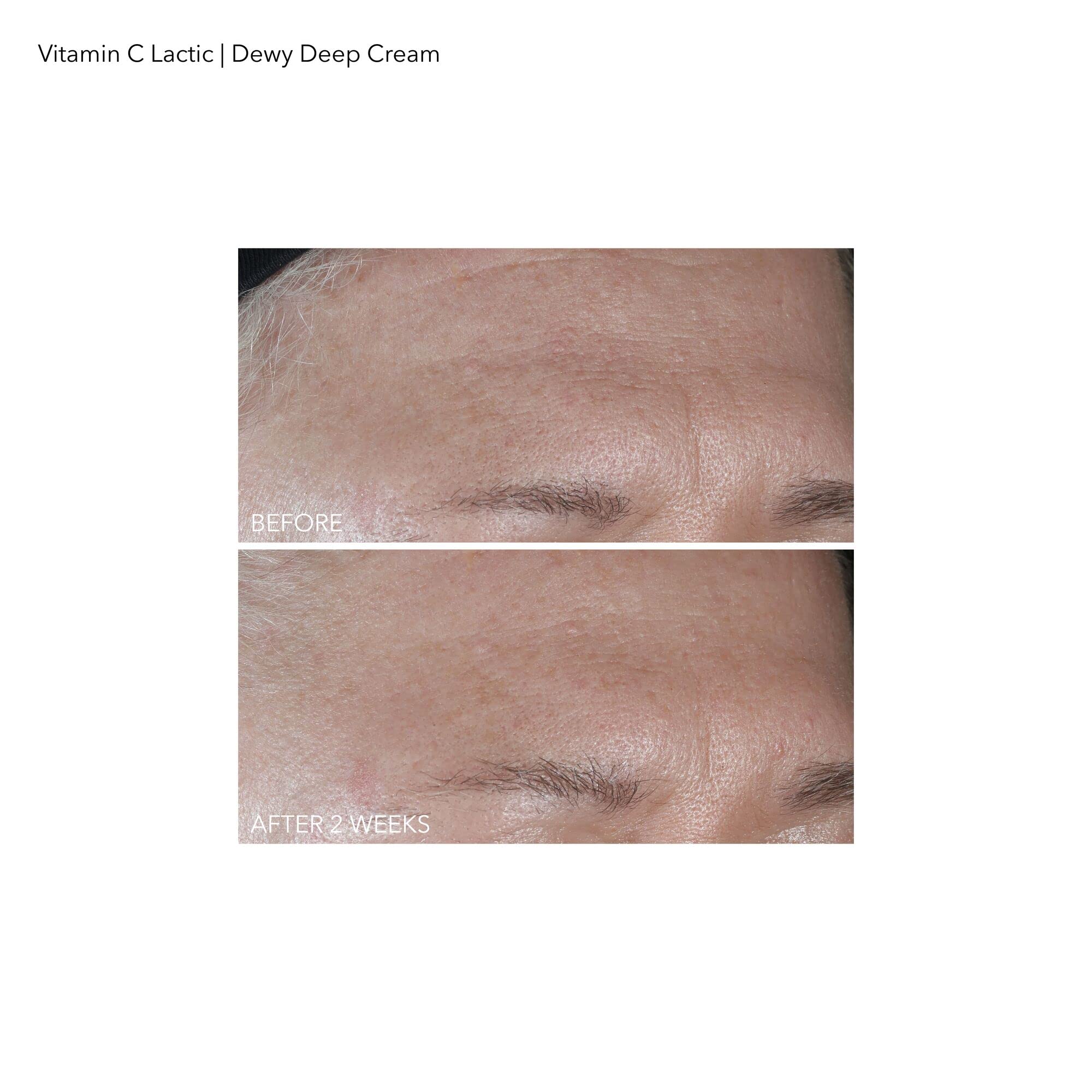 Morning routine use of Dr Dennis Gross Vitamin C Lactic Dewy Deep Cream
