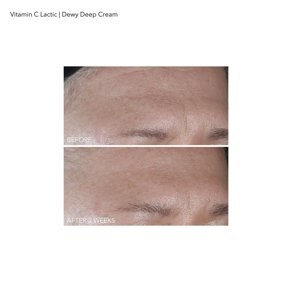 Morning routine use of Dr Dennis Gross Vitamin C Lactic Dewy Deep Cream