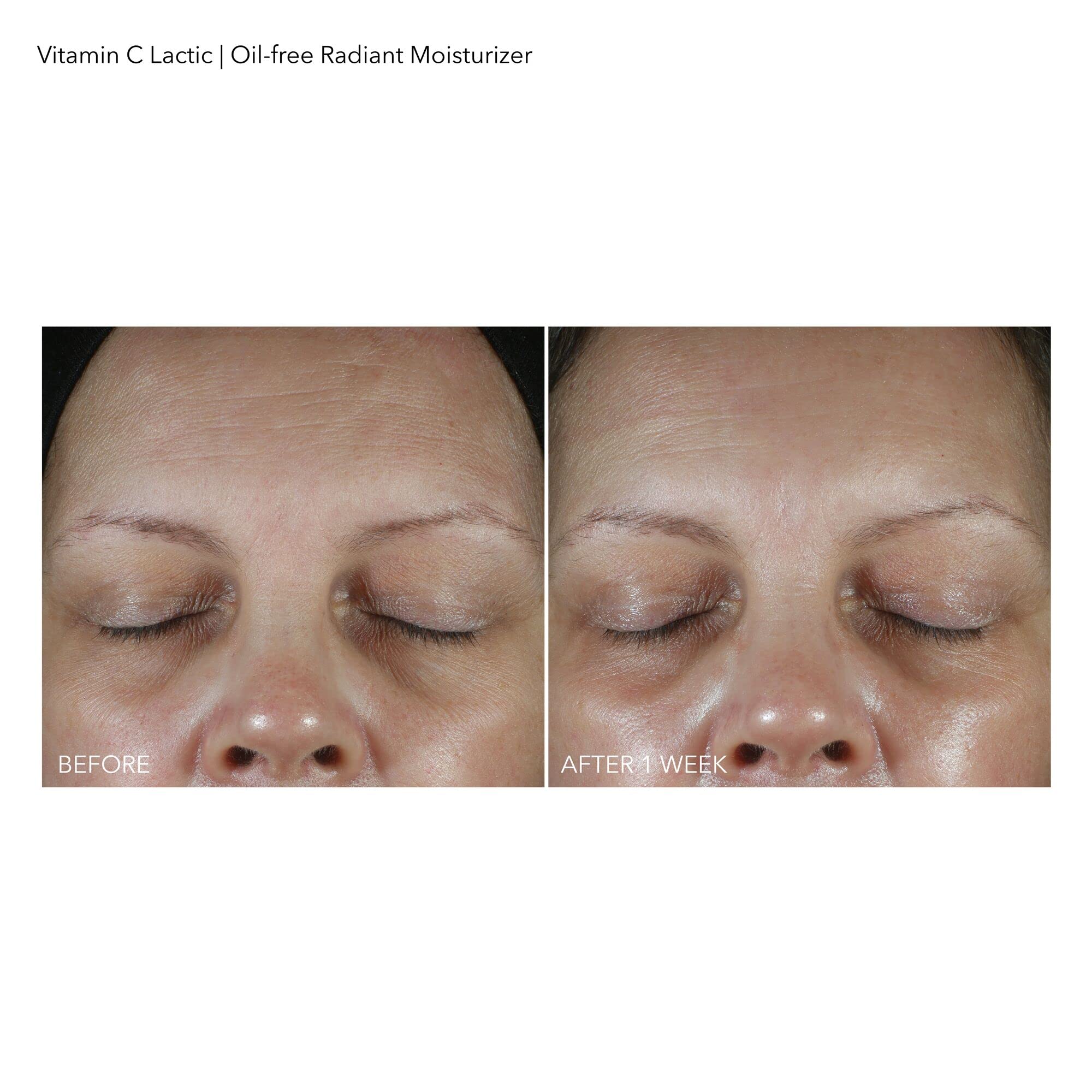 Dr Dennis Gross barrier-boost image implies stronger moisture barrier with daily use