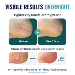 Dr. Frederick's Original moisturizing heel socks two-pair set ready for gifting