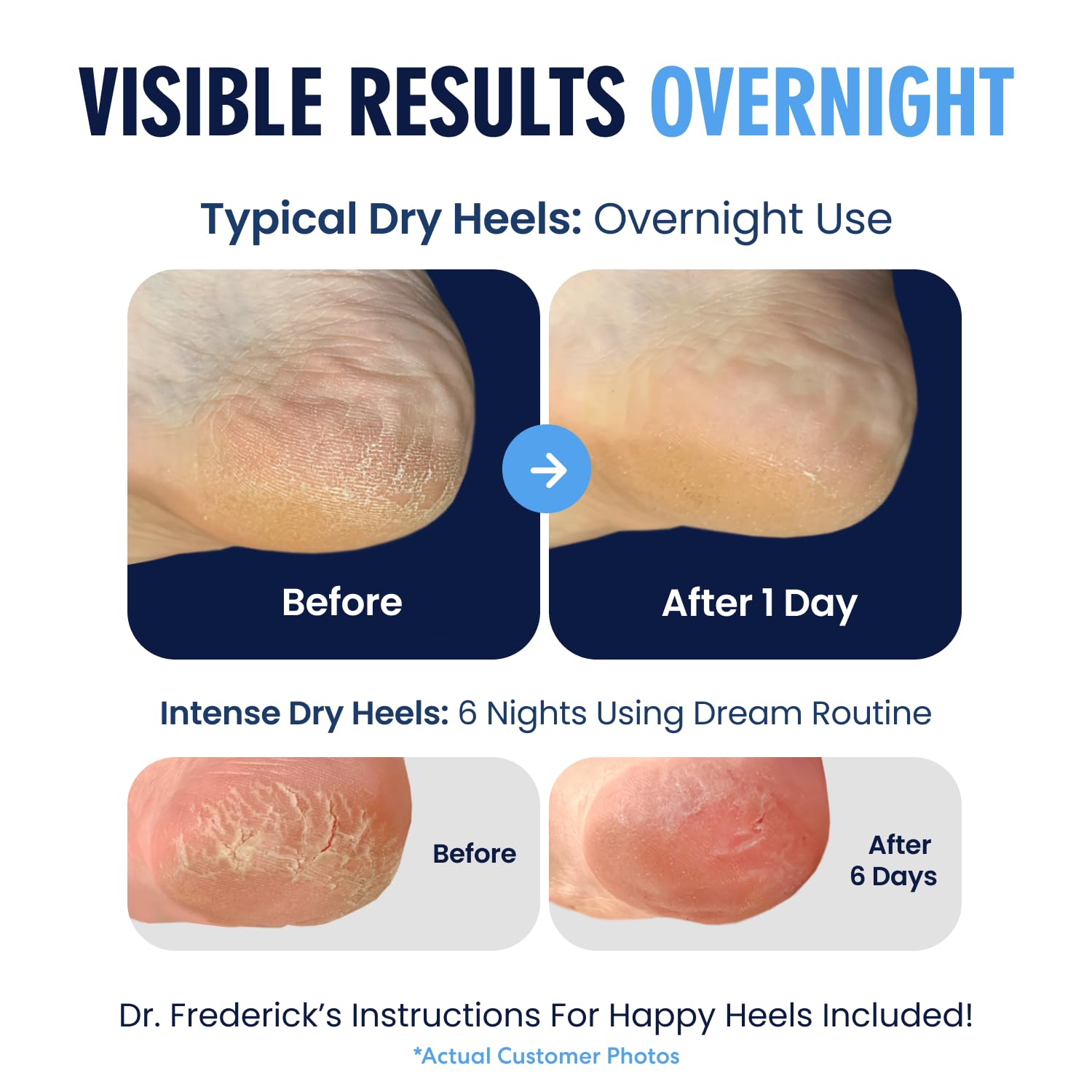 Overview of Dr Frederick's Original moisturizing heel socks with breathable fabric.