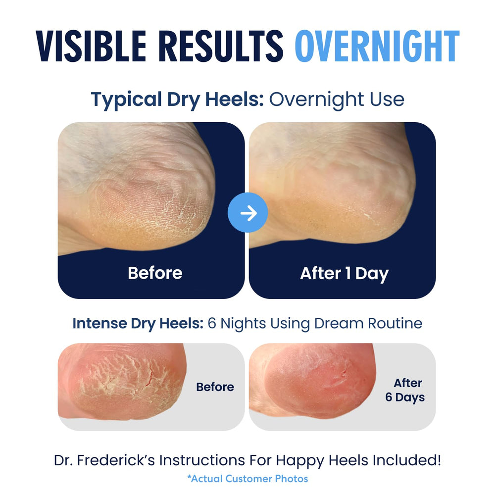 Overview of Dr Frederick's Original moisturizing heel socks with breathable fabric.