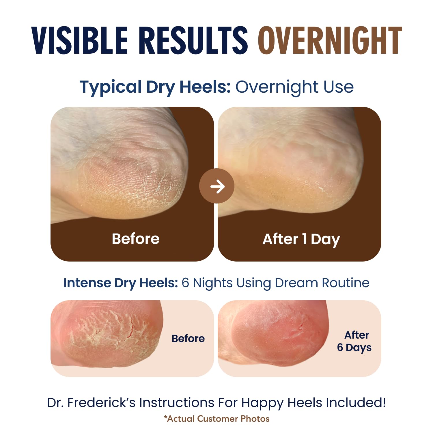 Two-pair package of Dr. Frederick's Original moisturizing heel socks for everyday relief.