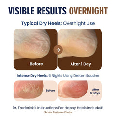 Two-pair package of Dr. Frederick's Original moisturizing heel socks for everyday relief.