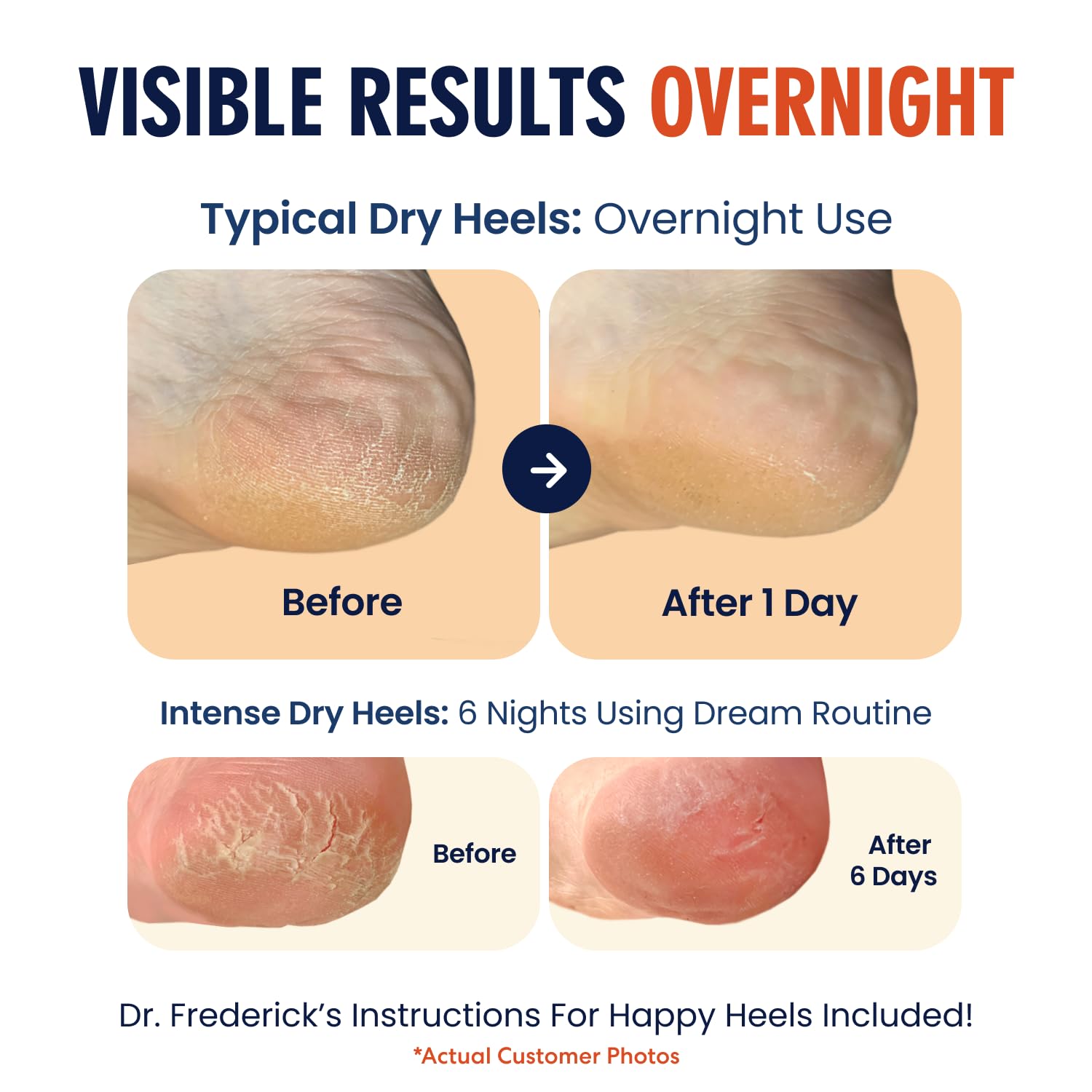 Dr. Frederick's Original heel socks on foot highlight breathable, comfortable wear.