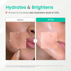 Dr.G gel close-up highlights ceramides for hydration support