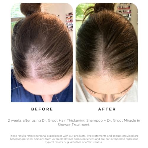 Dr. Groot damaged hair before-after visuals indicating hydration and resilience.
