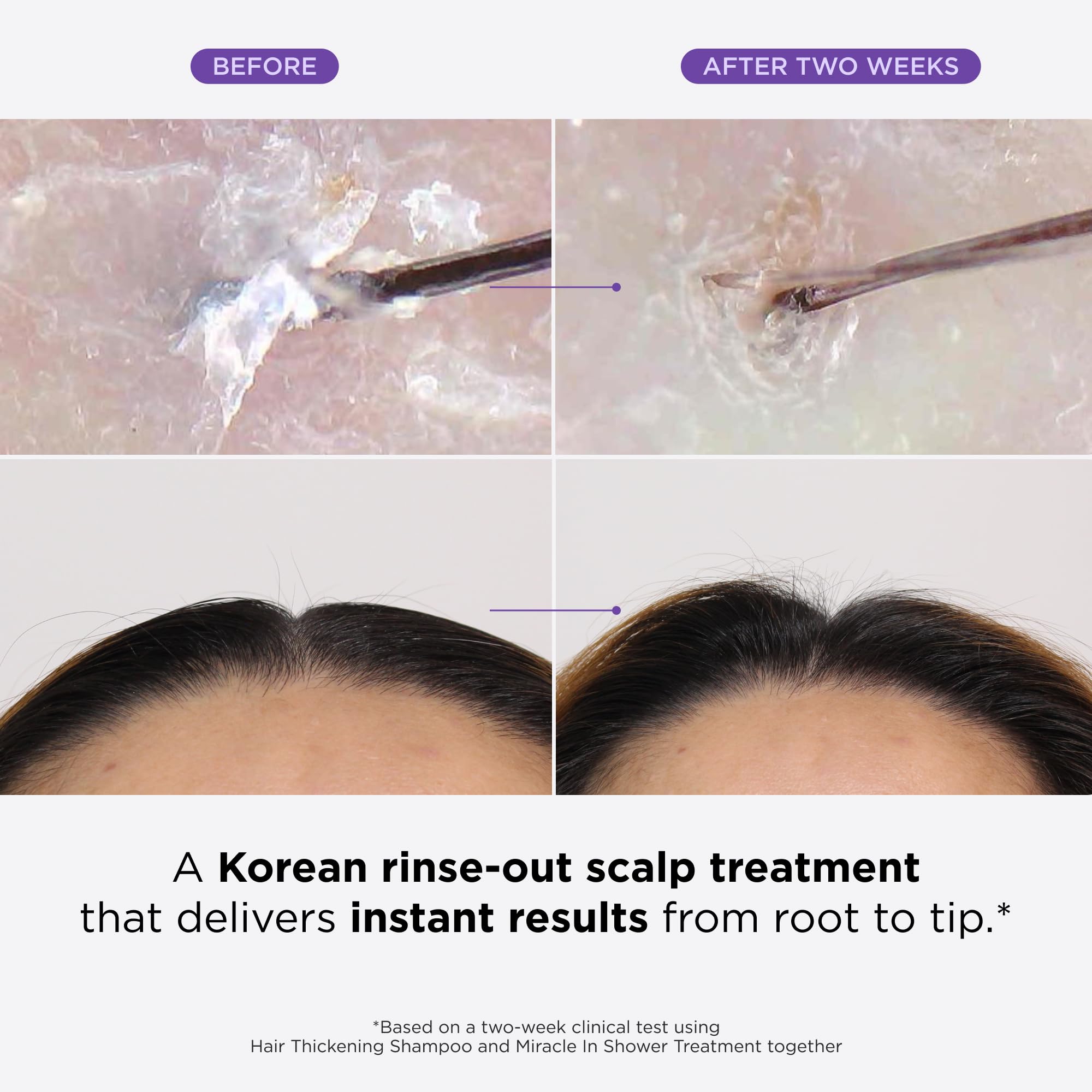 Dr. Groot Miracle in Shower bottle angled view for fast 5-second softness boost.