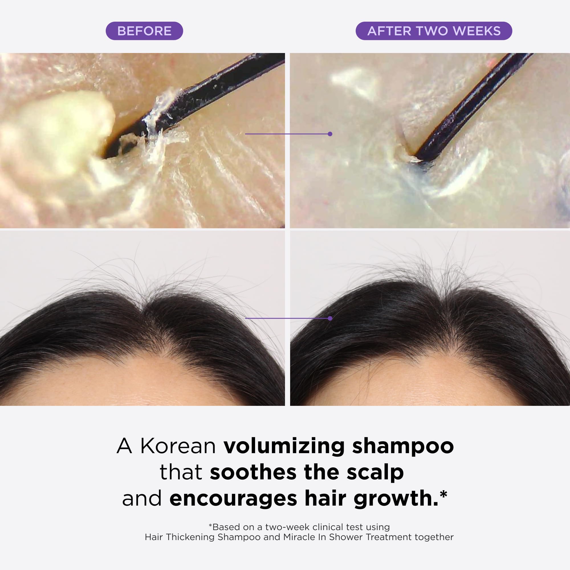 Dr. Groot rosemary oil bottle delivers refreshing scalp care