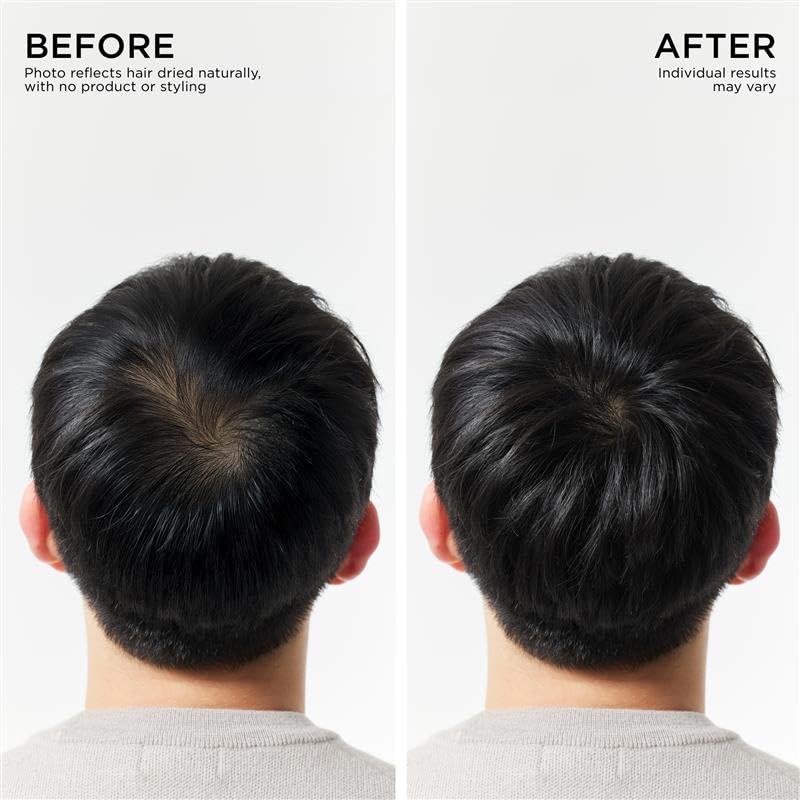 Dr. Groot scalp care action image illustrating exfoliation and pore-clearing benefits.