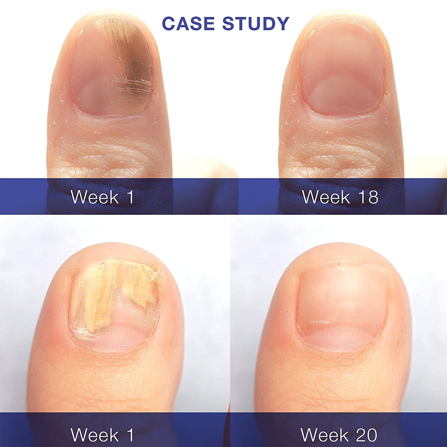 Dr. Luke Nail Repair Liquid brush application demonstrates precise daily nail care.