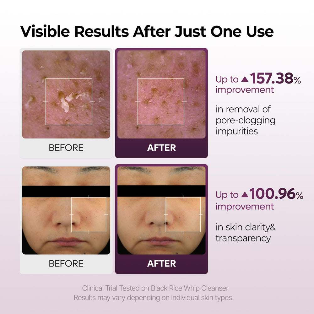 Dr.Melaxin Peel Shot black rice ingredients hint at refreshed skin.