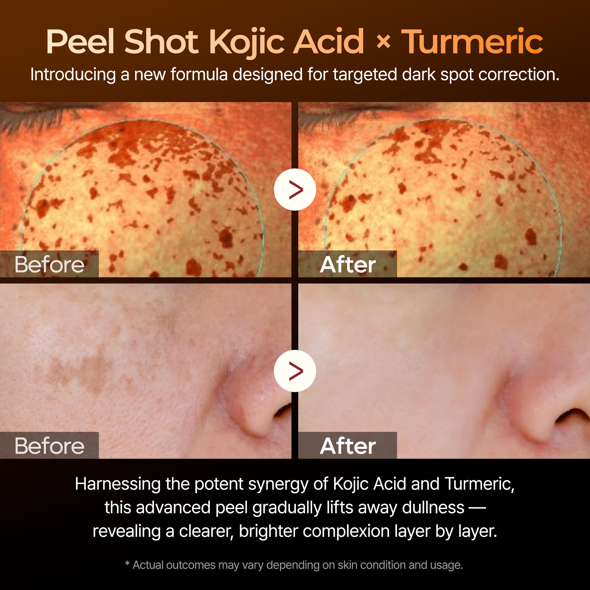 Dr.Melaxin Kojic Acid swirl hints at brightening formulation