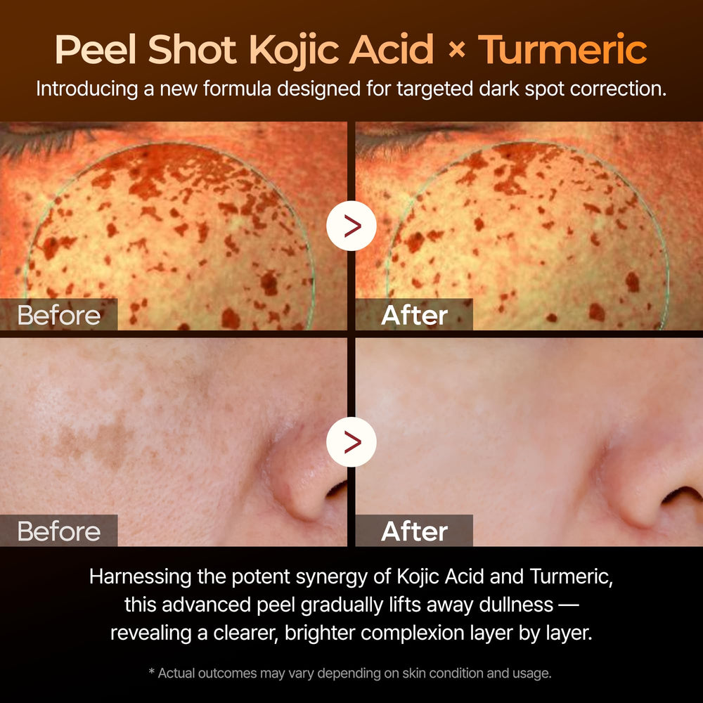 Dr.Melaxin Kojic Acid swirl hints at brightening formulation