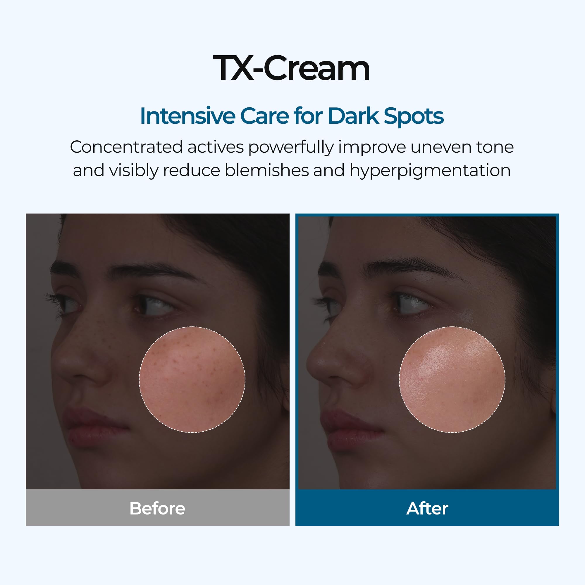 Dr.Melaxin TX Cream texture close-up reveals rich, moisturizing formula