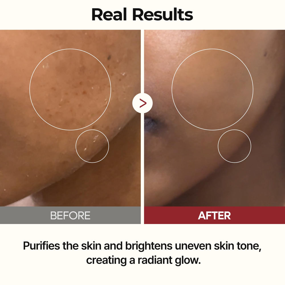 Dr.Melaxin Rice Water Vitamin B nourishes the skin.