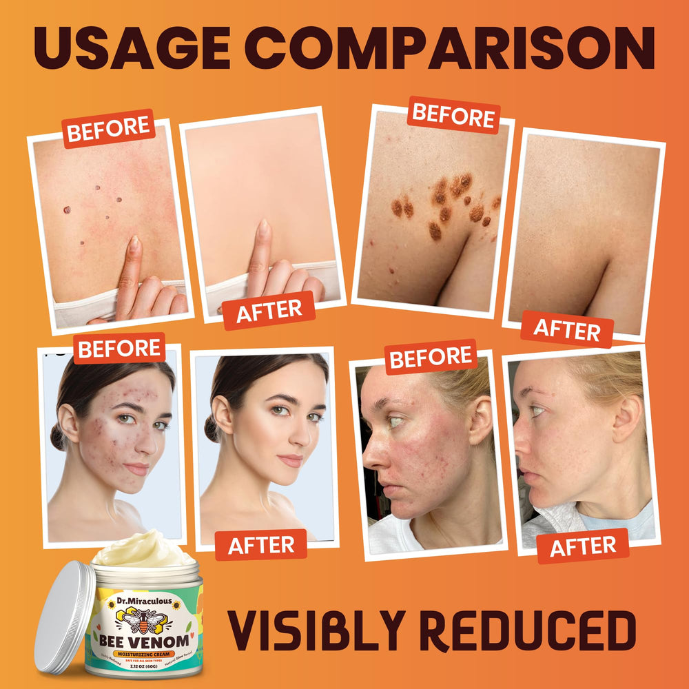 Dr. Miraculous Bee Venom Skin Cream cruelty-free label signals ethical skincare