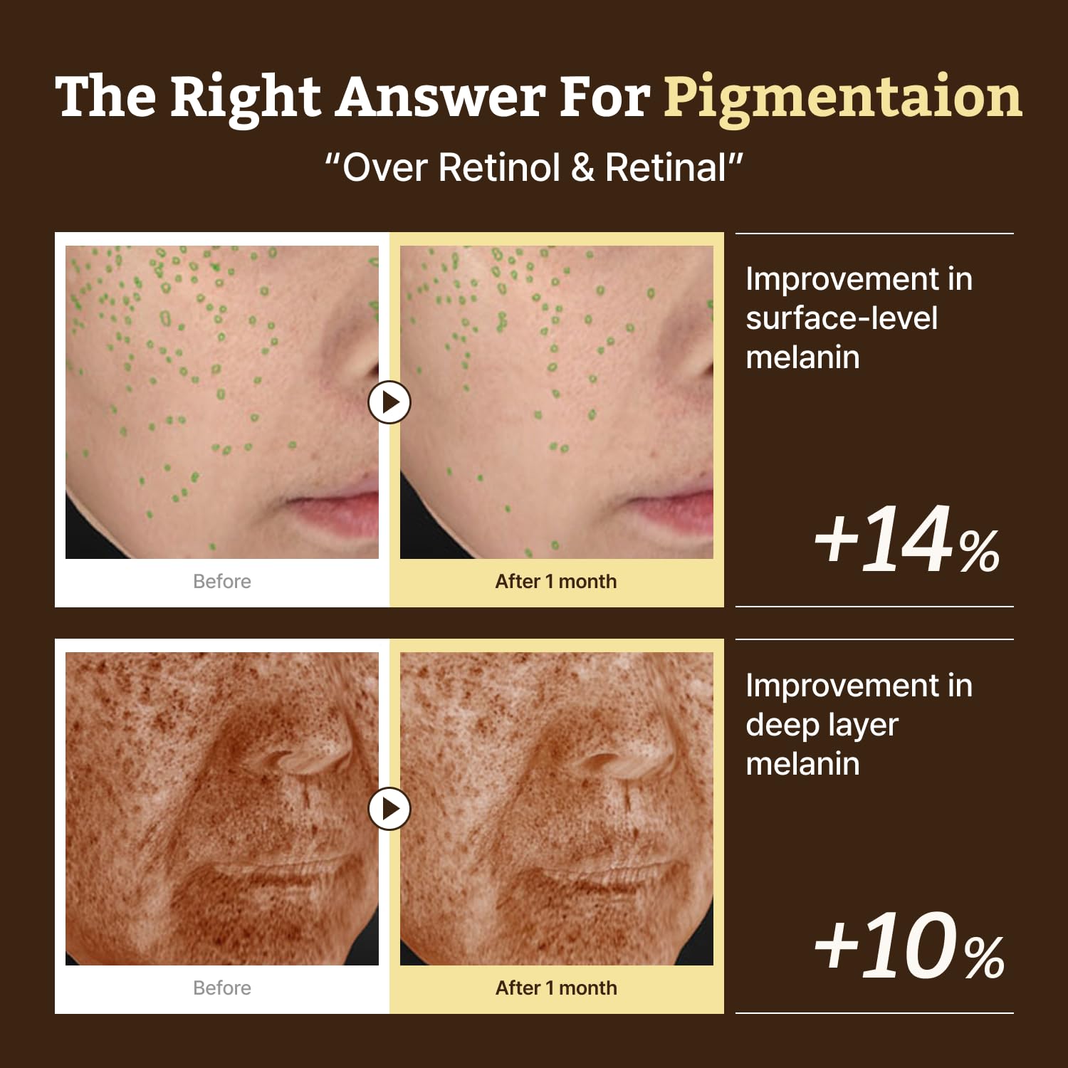Dr.Reju-All Retino-Mela Serum TXA 4% focus supports clear-looking complexion