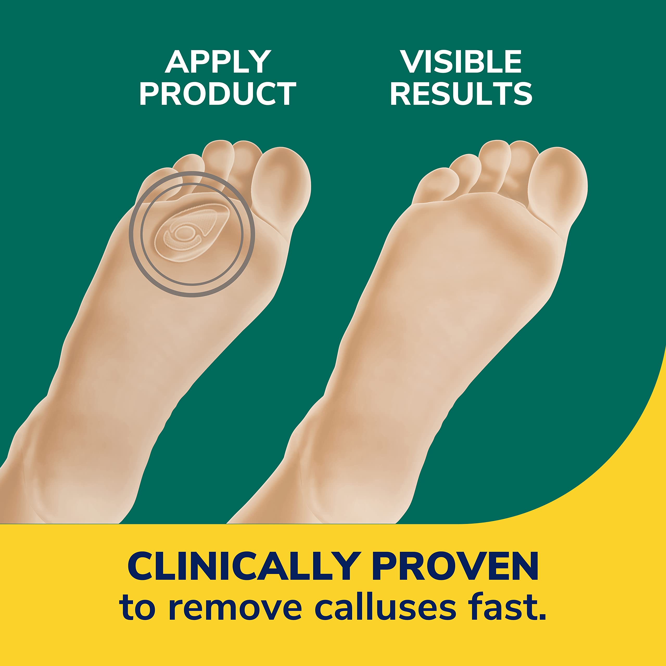 Dr. Scholl's hydrogel texture detail showing soft cushioning