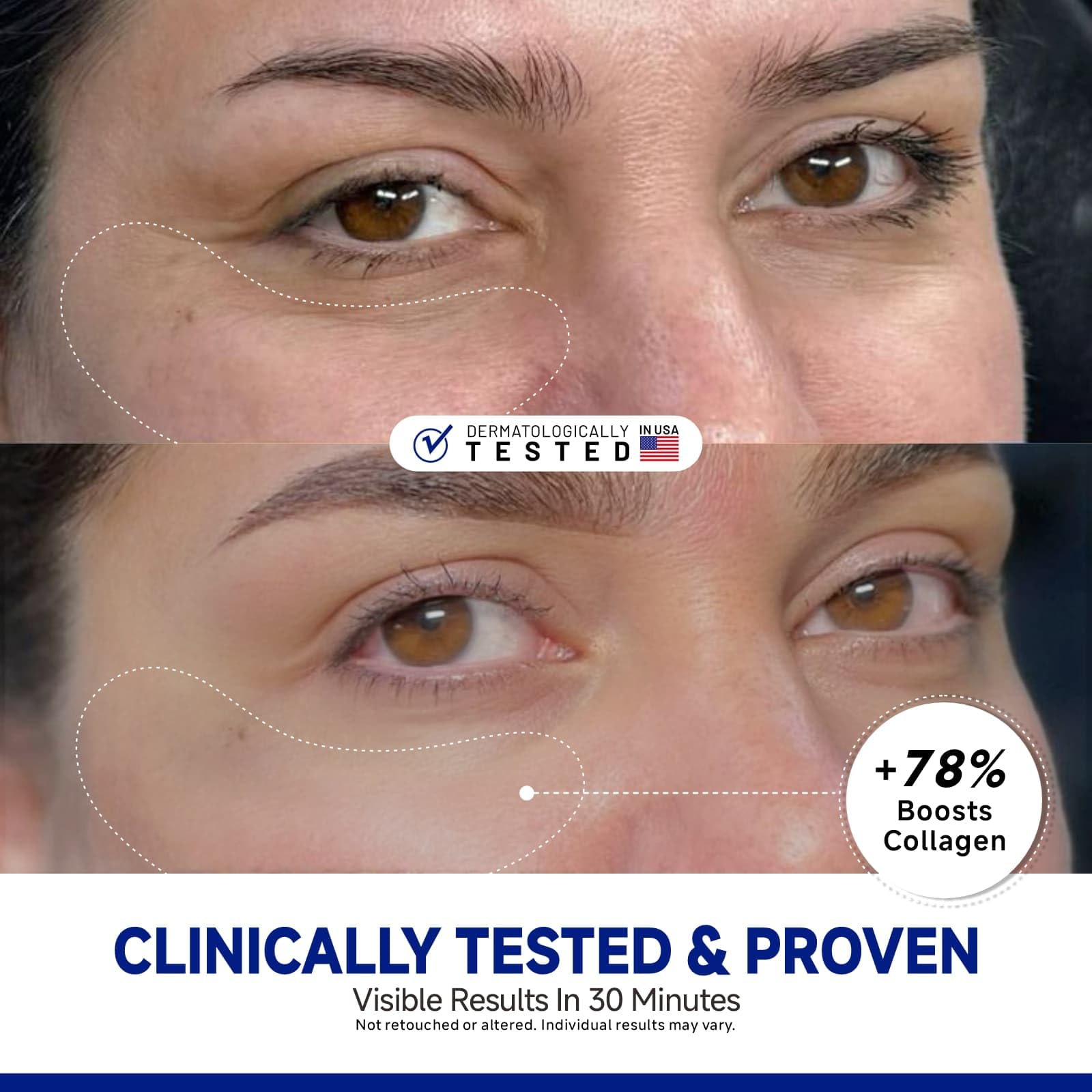 Dr Vincent peptide-under-eye-patches close-up shows texture and premium formulation.