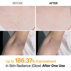 Dr.Melaxin Body Keratin Care label highlights keratin kojic turmeric ingredients.