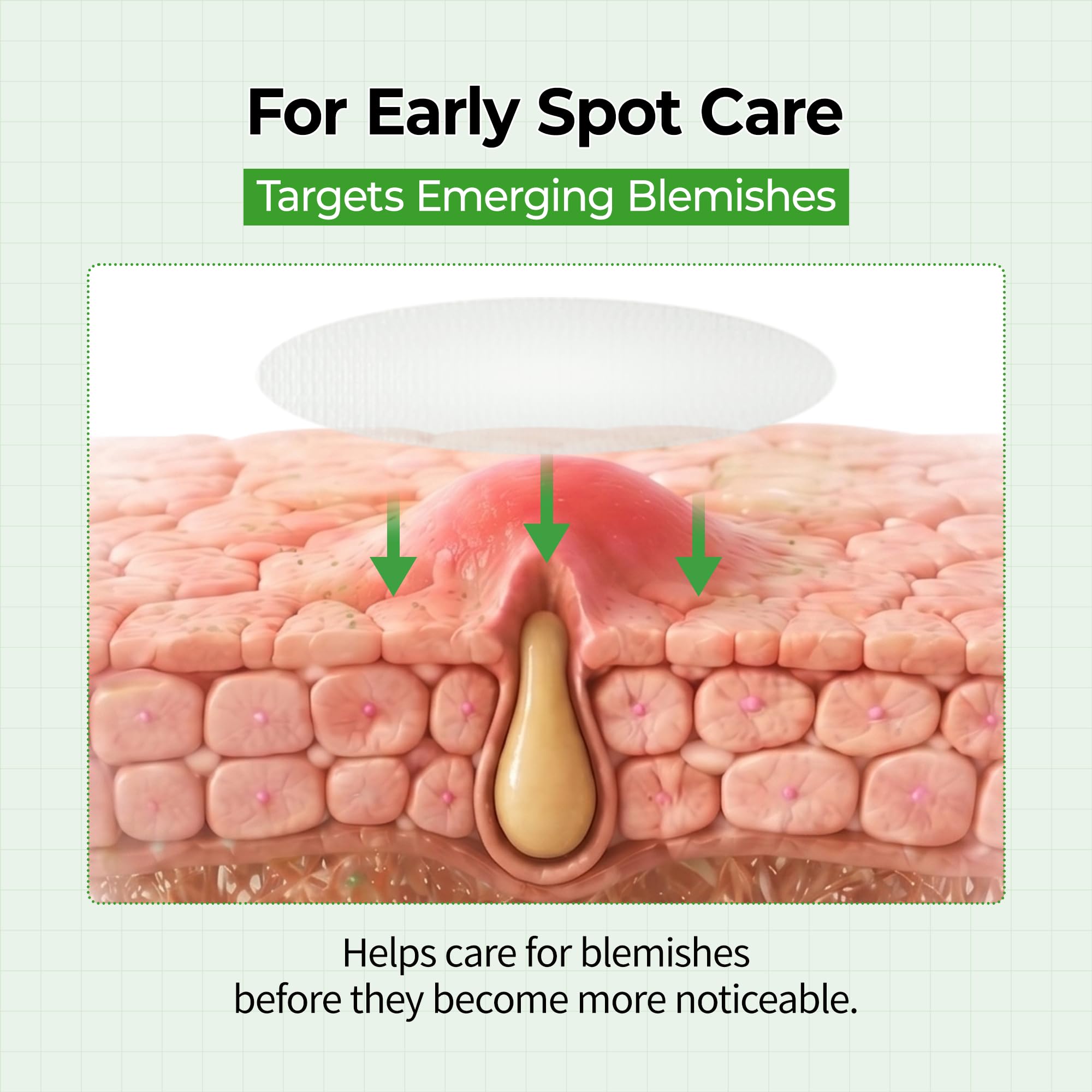 Dr.Melaxin ingredient illustration highlighting salicylic acid and sulfur