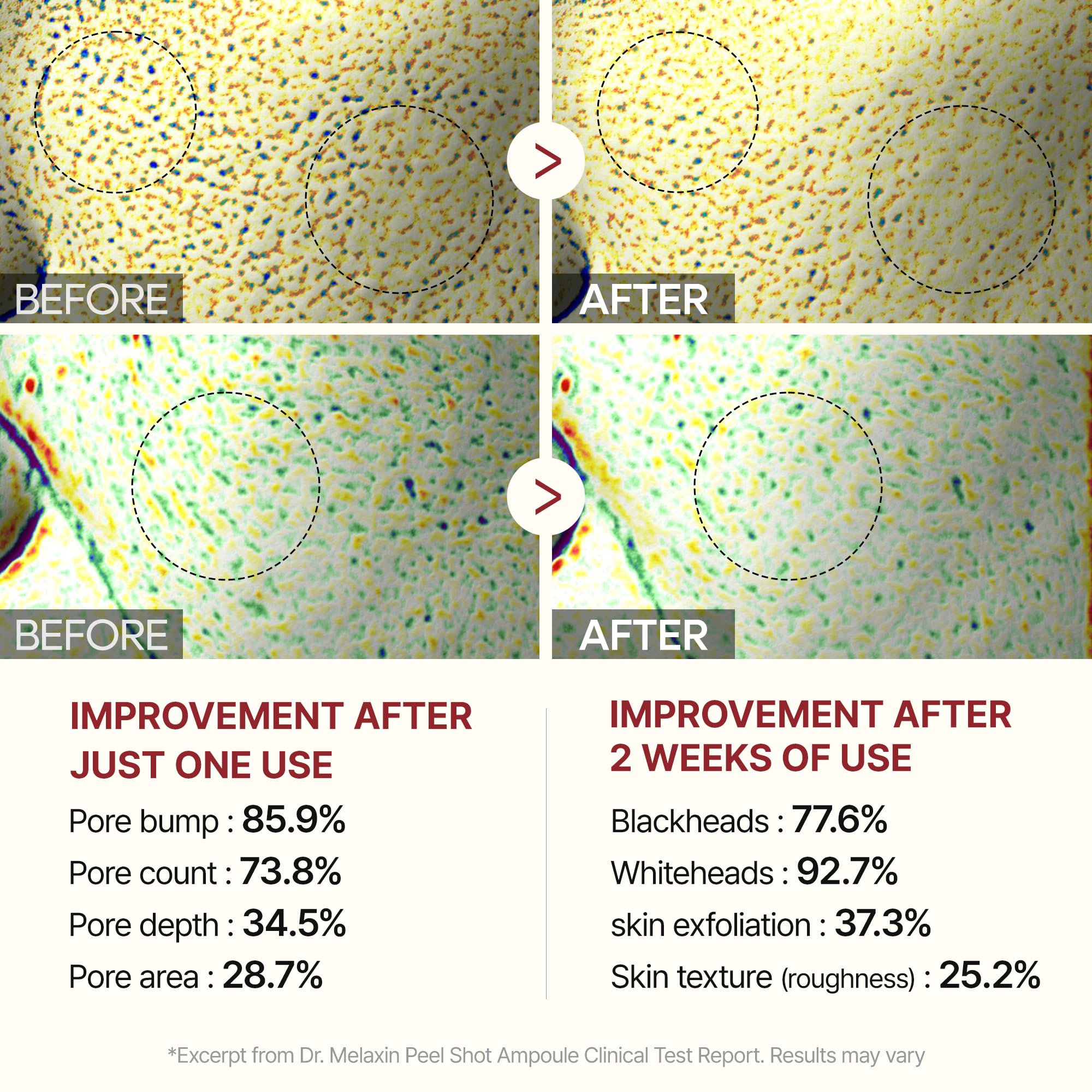 Dr.Melaxin Peel Shot Glow rice extract illustration highlights Niacinamide benefits.