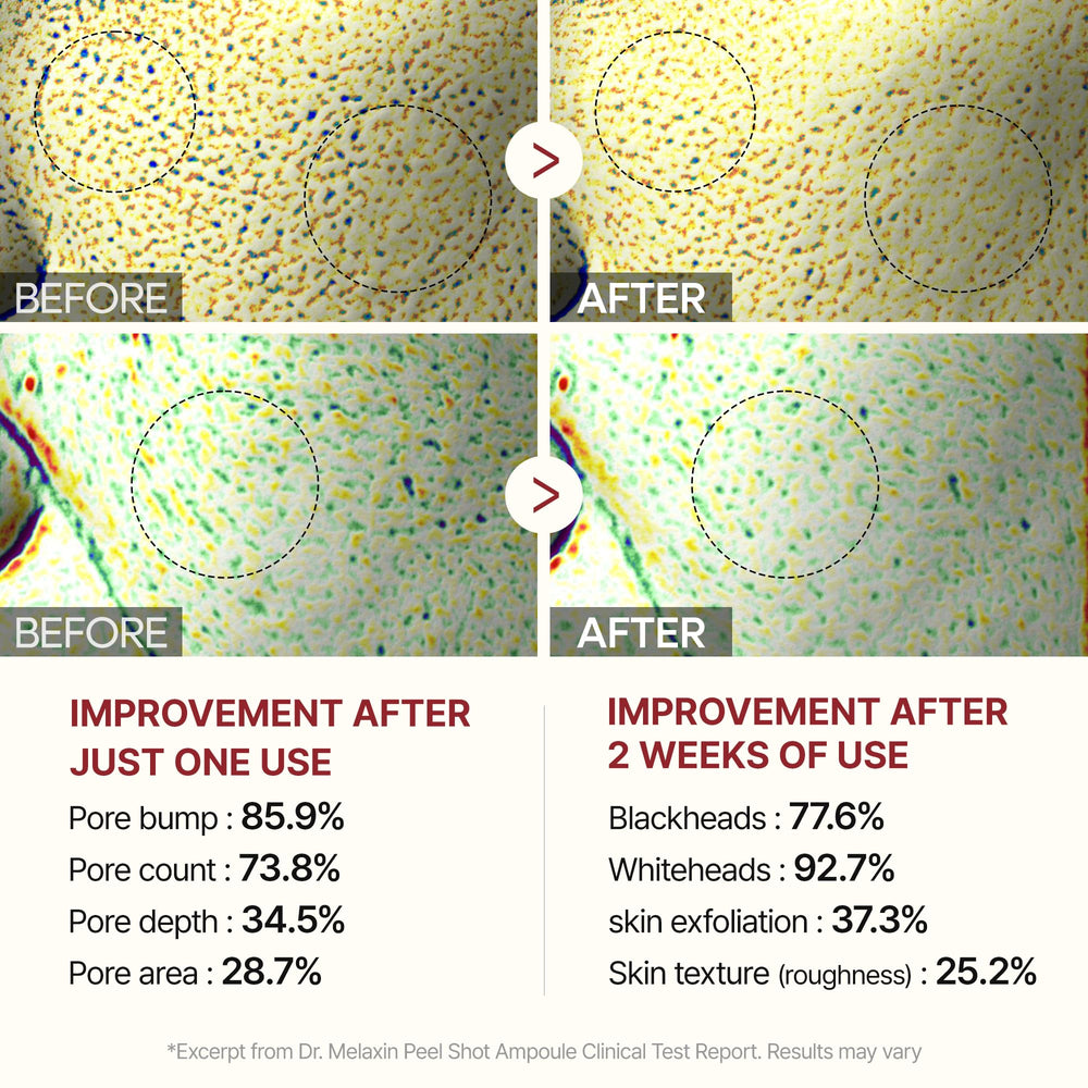 Dr.Melaxin Peel Shot Glow rice extract illustration highlights Niacinamide benefits.