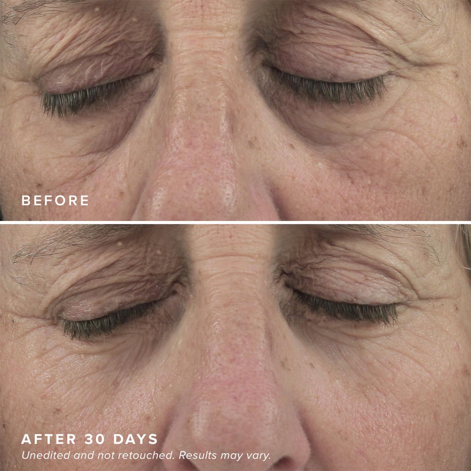 Two patches placed under the eyes during a quick routine.