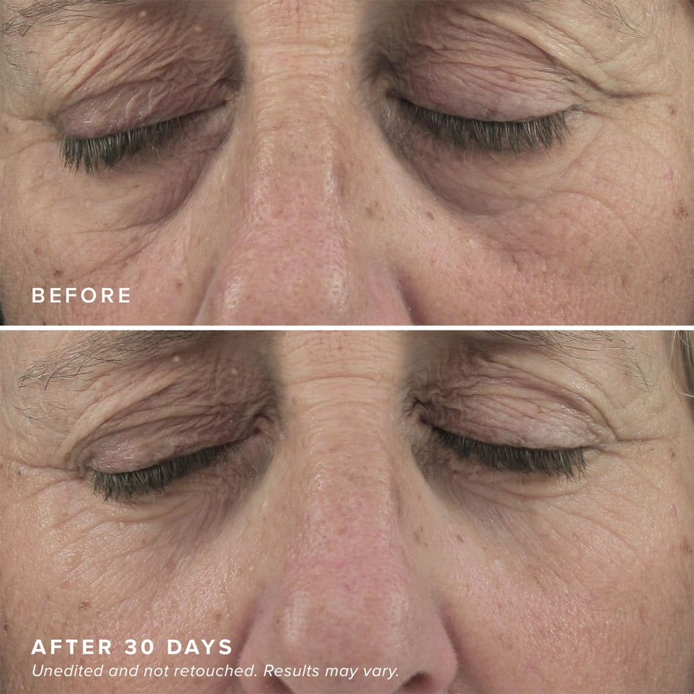 DRMTLGY two-pack display emphasizing value and easy at-home skincare for eyes.