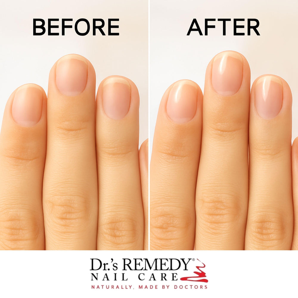Dr.'s Remedy biotin and tea tree oil nourish conditioning nails.