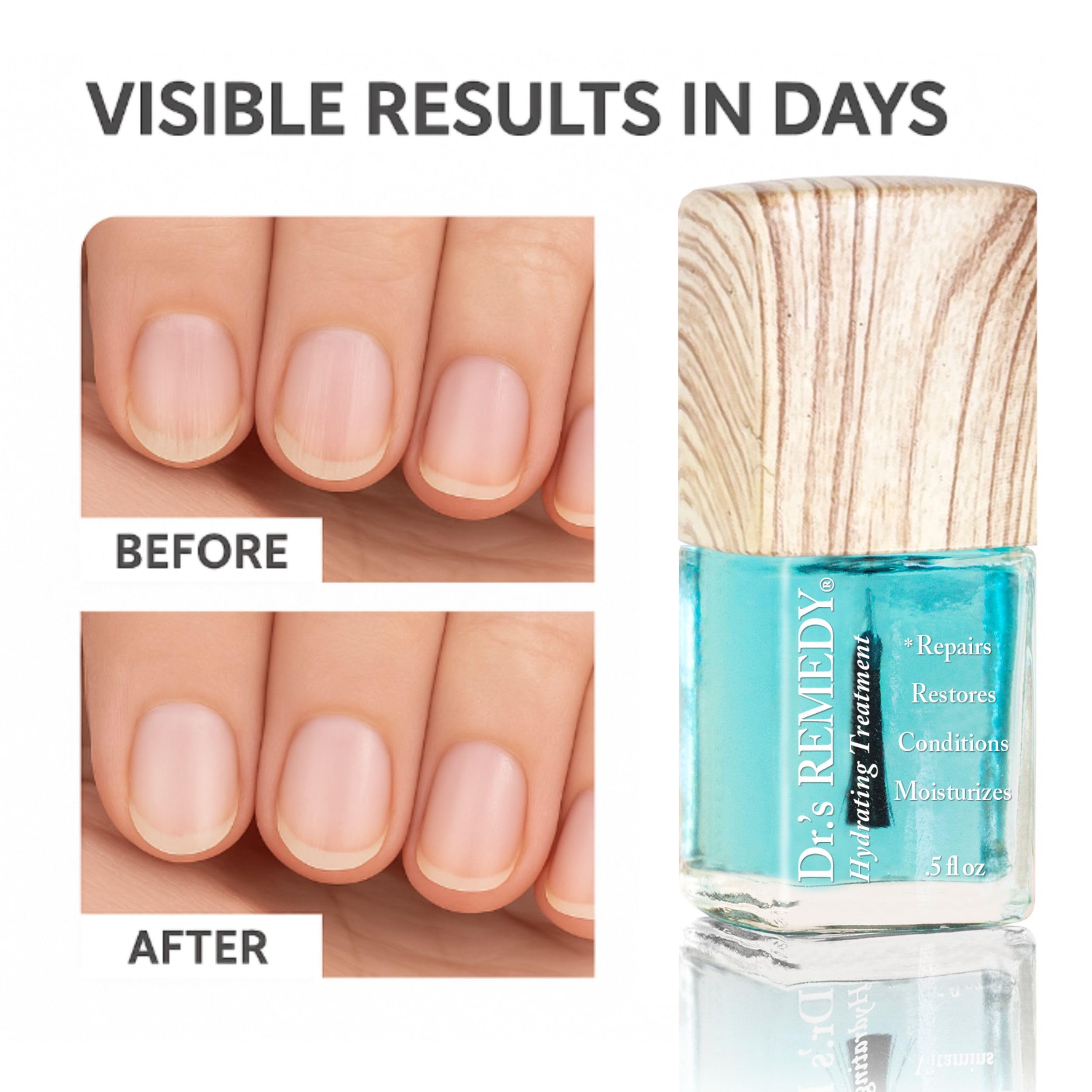 Dr.'s Remedy total two-in-one bottle closeup emphasizing streamlined nail care