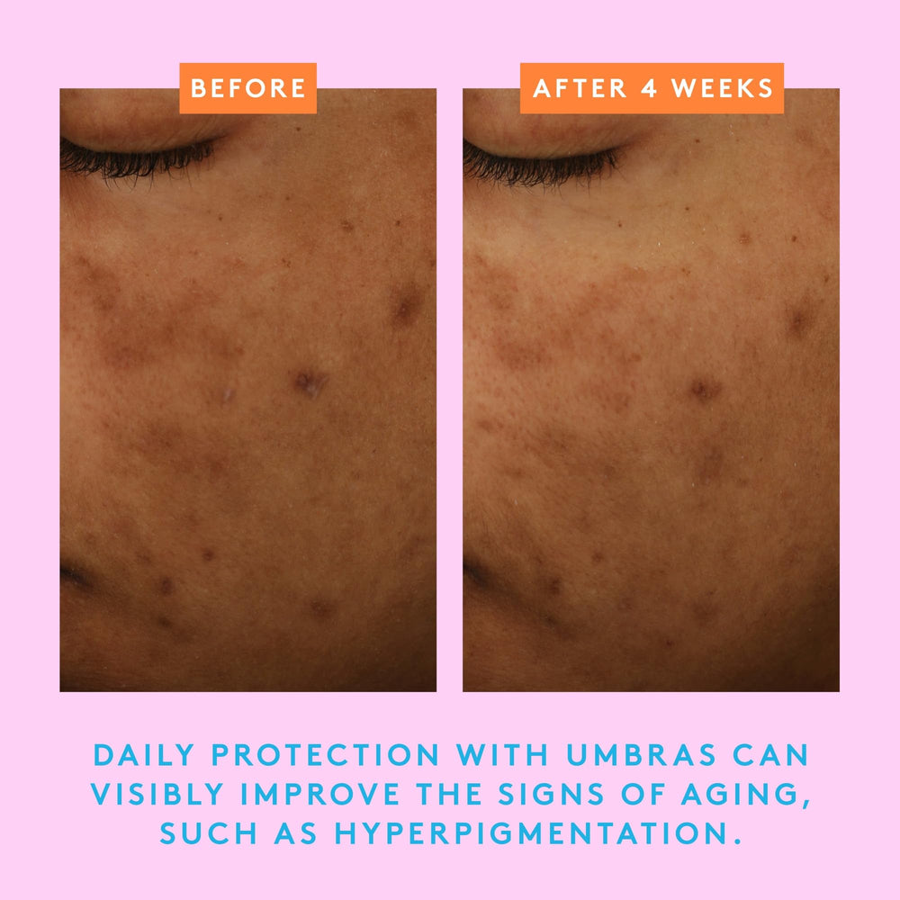 Daily-use emphasis notes absence of essential oils and fragrances for sensitive-skin routines.