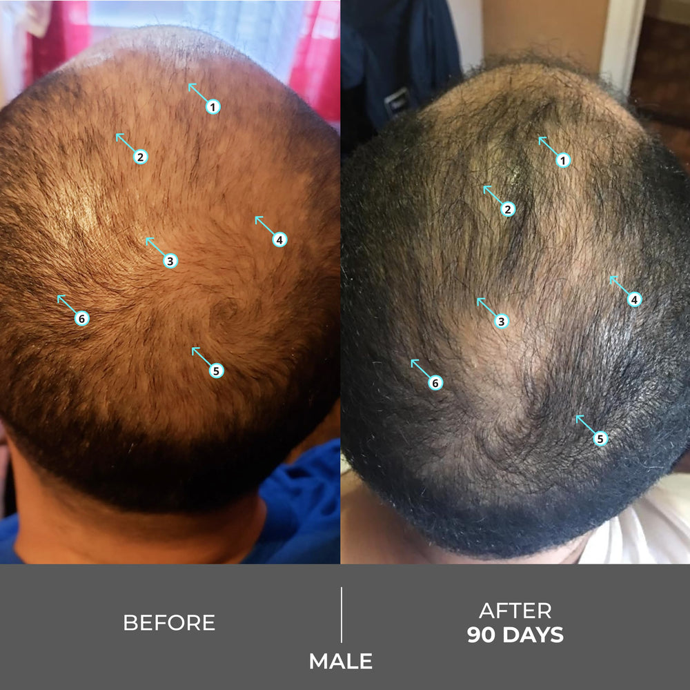 DS Laboratories Revita application on scalp shows scalp-first cleansing concept.