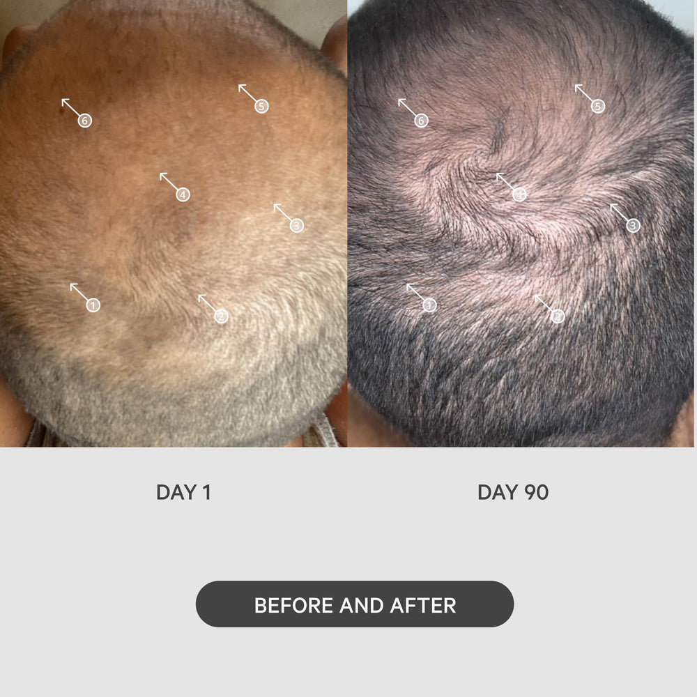 DS Laboratories StimuROLLER used on scalp with serums to improve absorption