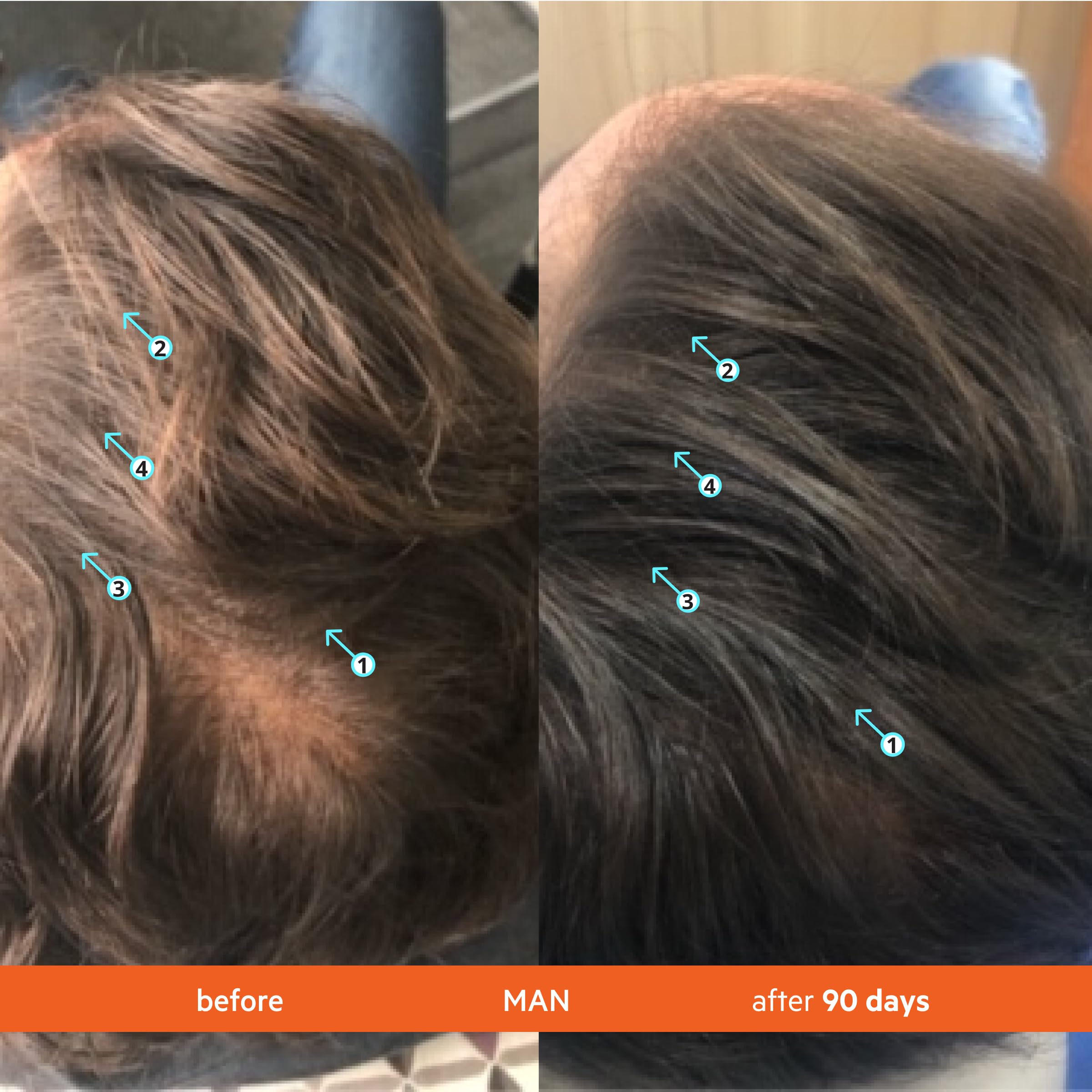 DS Laboratories Revita Shampoo pour closeup illustrating foamy scalp cleanse.