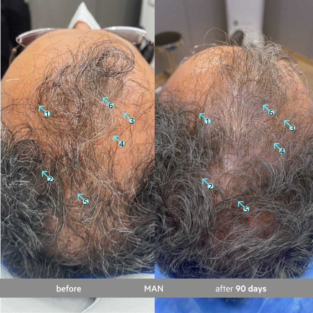 DS Labs Spectral Extra Strength Hair Density Serum apply-scalp shows targeted density support.