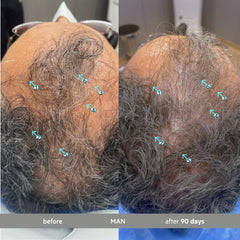DS Labs Spectral Extra Strength Hair Density Serum apply-scalp shows targeted density support.