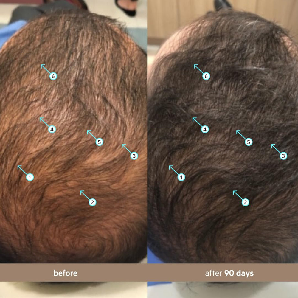DS Laboratories Spectral Men’s Density Serum application on scalp showing quick absorption