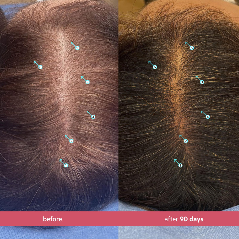 DS Laboratories Spectral Women’s Hair Density Serum application on scalp demonstrates targeted care