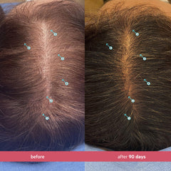 DS Laboratories Spectral Women’s Hair Density Serum application on scalp demonstrates targeted care
