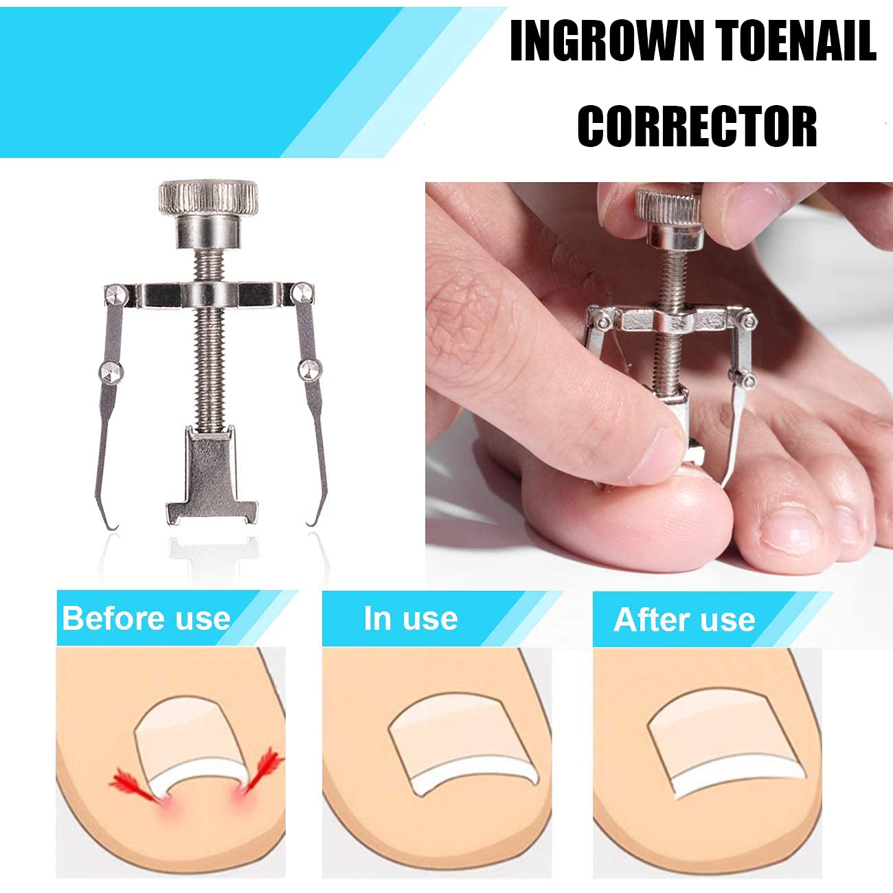 Dualeco anti-splash clip cover keeps work area clean