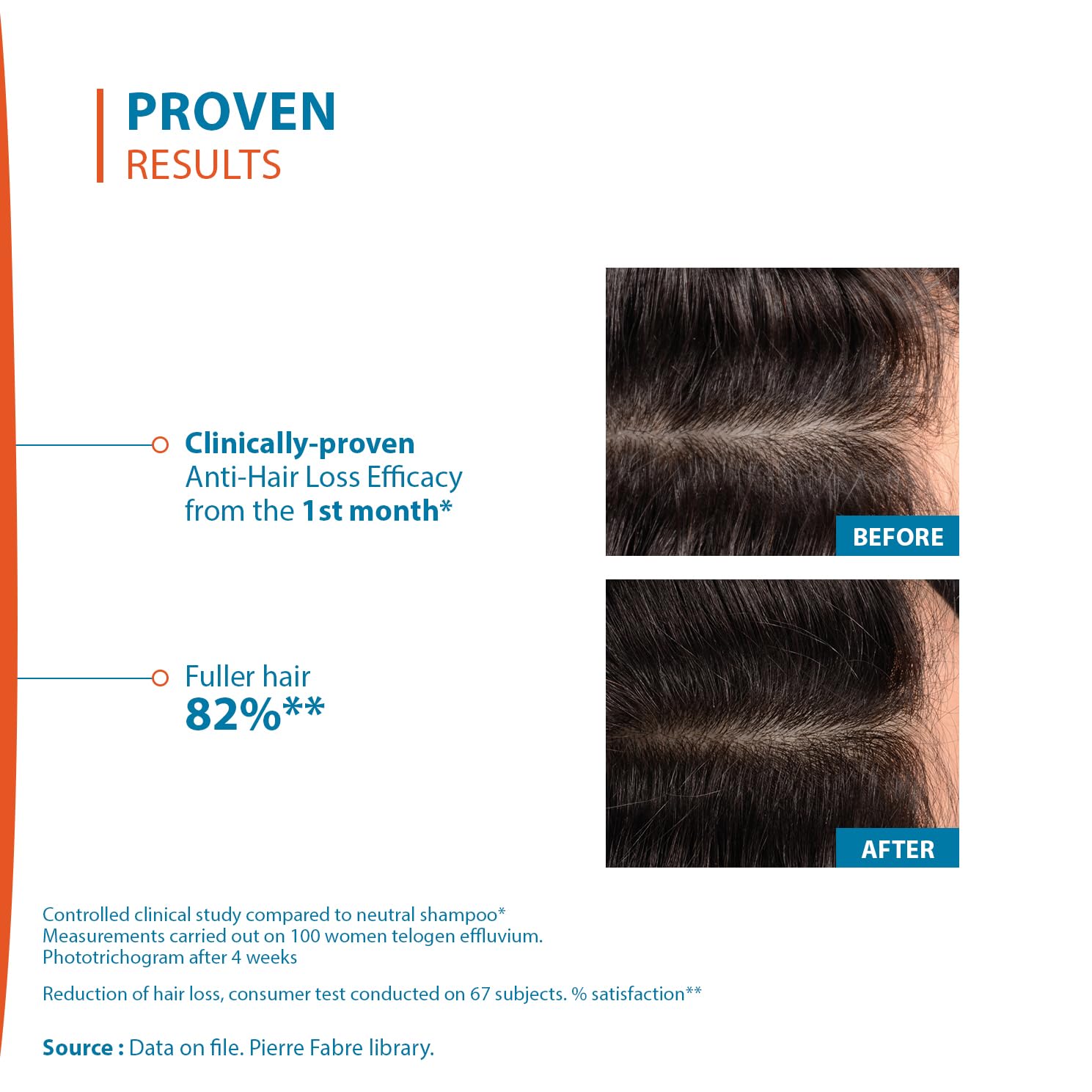 Ducray Creastim Reactiv peptide complex emphasized for scalp vitality.