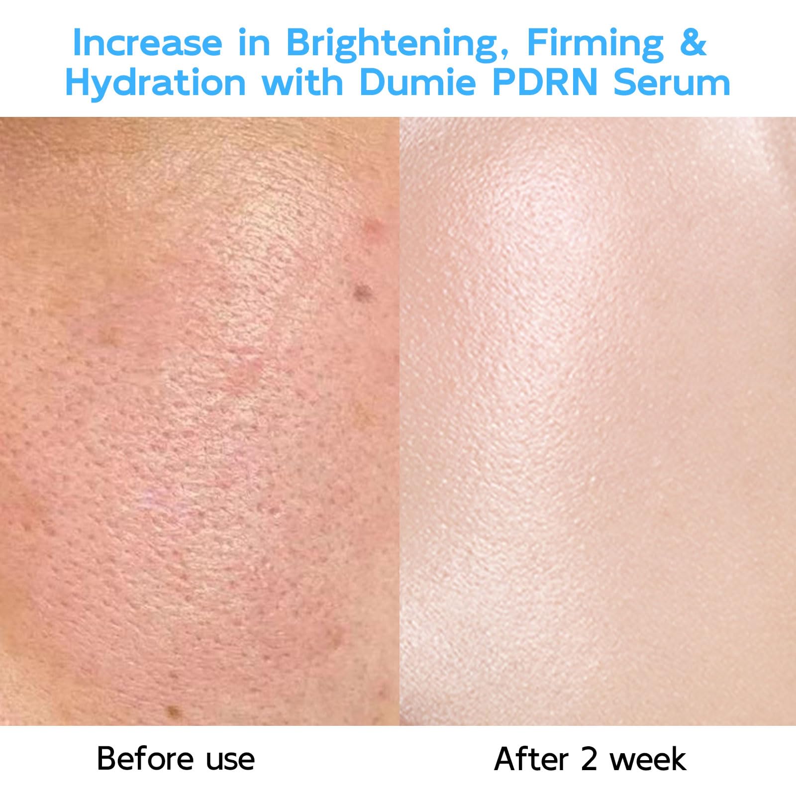 Dumie Salmon DNA Serum single-use tubes emphasize freshness for potent hydration on-the-go.