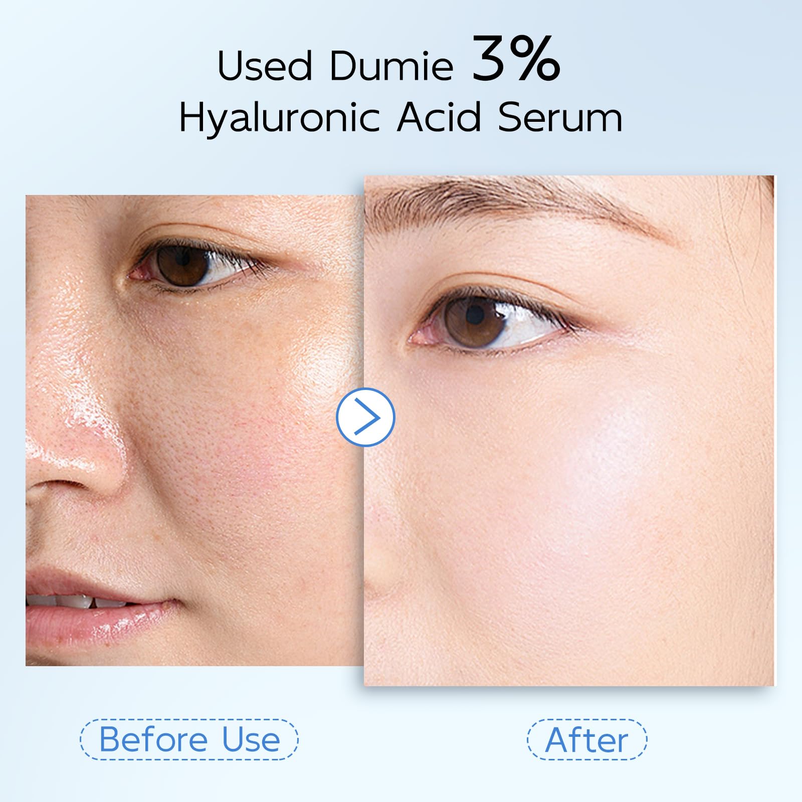 Dumie serum application on cheek demonstrates quick absorption and hydration